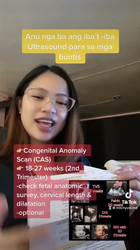 mga bata nag iyot|Ultrasound para sa Buntis: Lahat ng Dapat Mong Malaman.